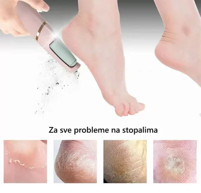 Električna turpija za pete i stopala – Vaš kućni salon ljepote